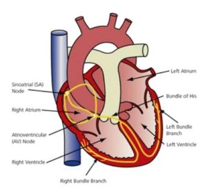 Cardiac Angiography Unit Pacemaker Implant Pre-Procedure leaflet ...